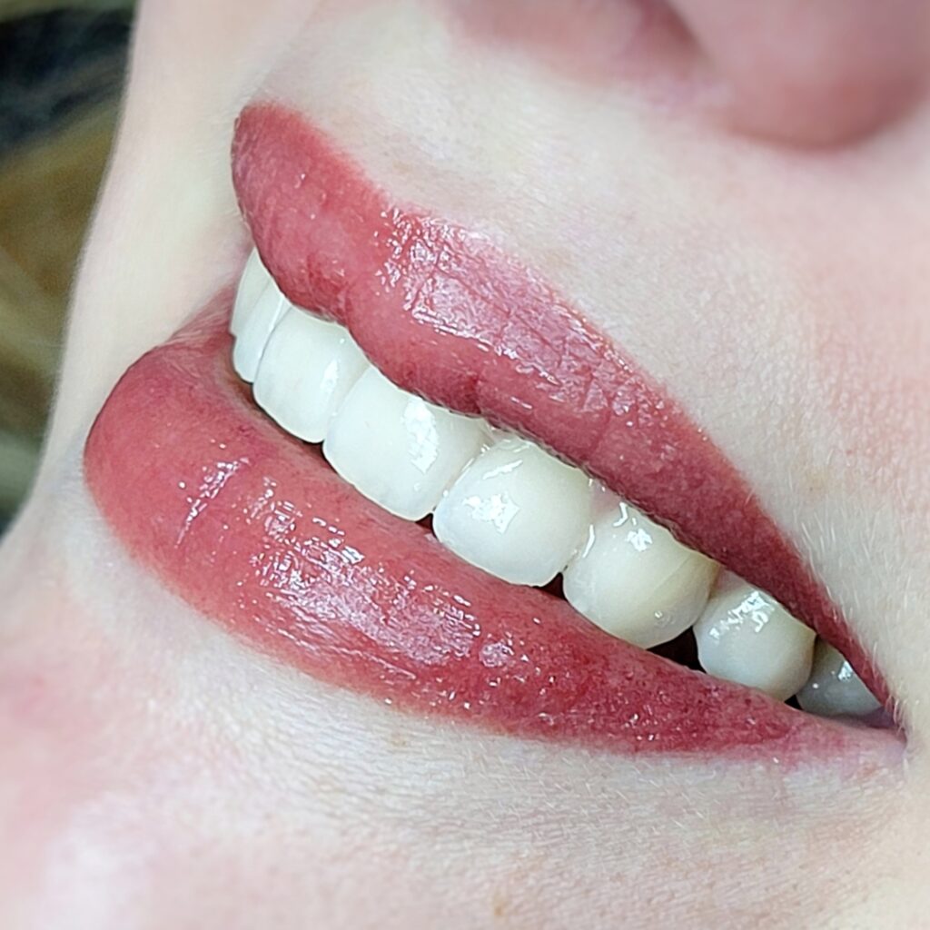 lippigmentatie
