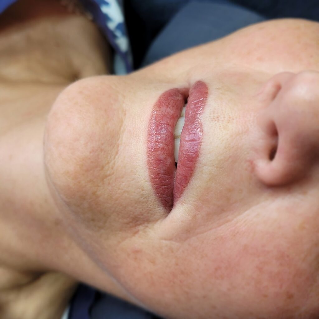 lippigmentatie
