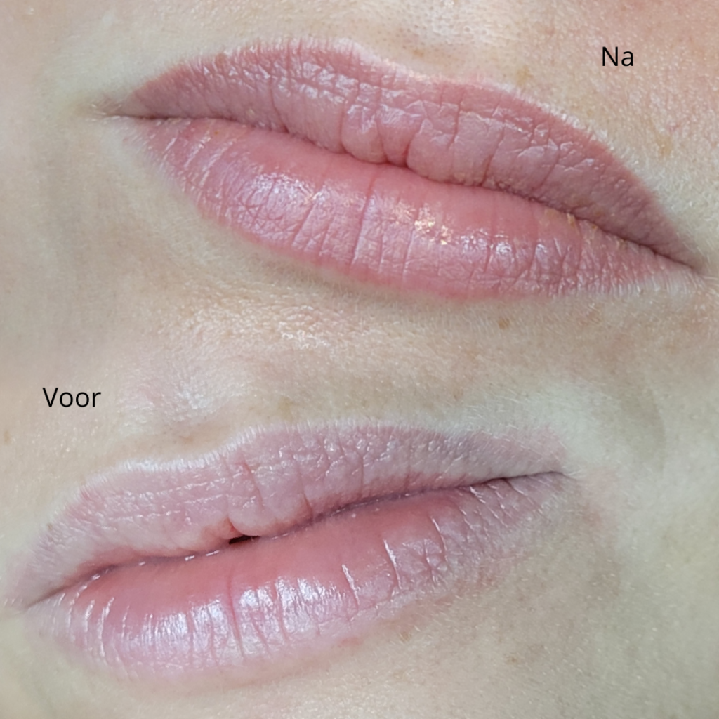 lippigmentatie