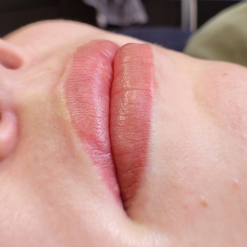 lippigmentatie