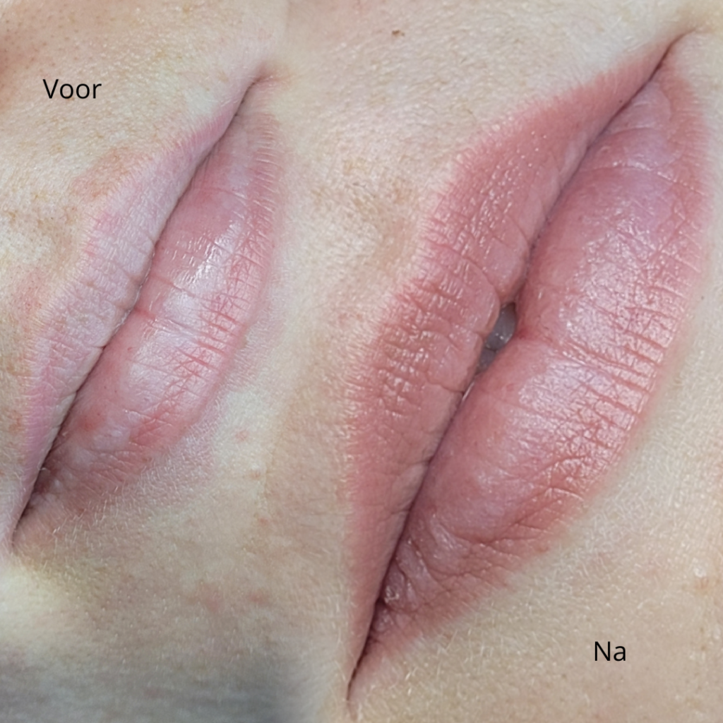 lippigmentatie