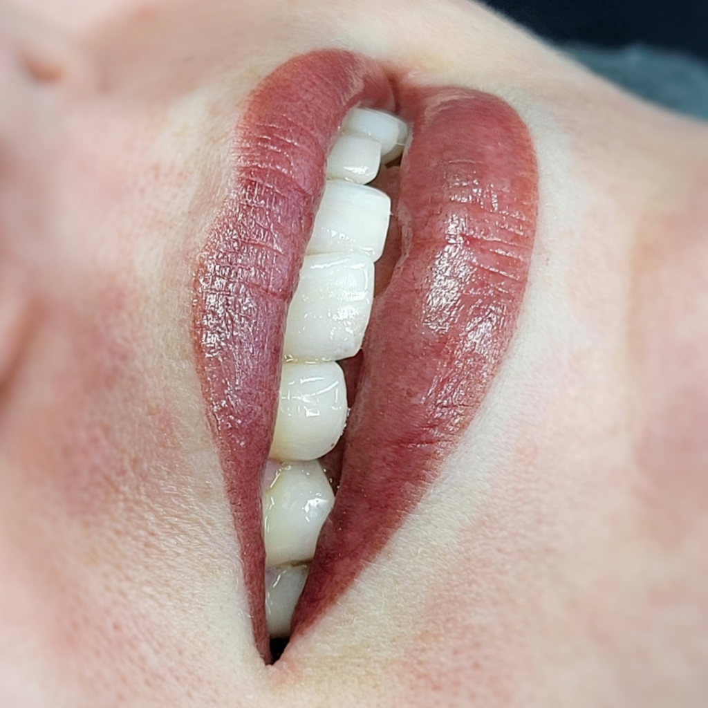 lippigmentatie